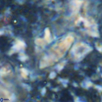 Discoasteroides kuepperi 48990