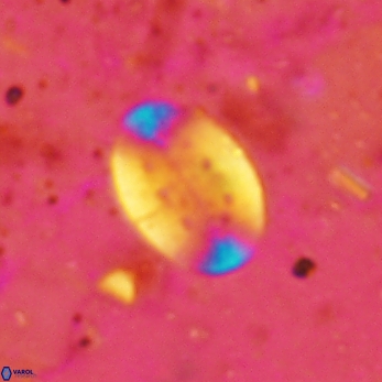 Pontosphaera araios 2421