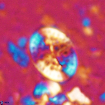 Pontosphaera desueta 15007