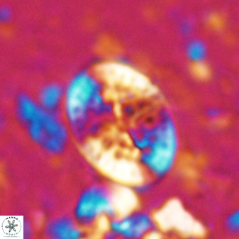 Pontosphaera desueta 15007