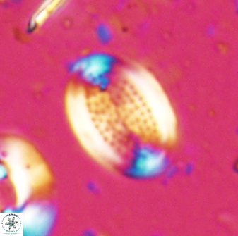 Pontosphaera decorata 29780