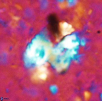 Discolithina ovata 48921