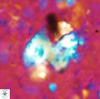 Discolithina ovata 48921