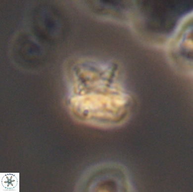Discorhabdus watkinsii 12515