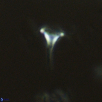 Discosphaera tubifera VR 04953