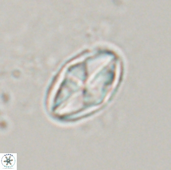 Dizeria vandekampiorum 17277
