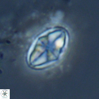 Dizeria vandekampiorum 17278