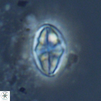 Dizeria vandekampiorum 17279