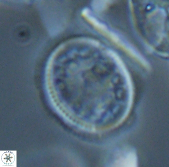Dodekapodorhabdus noeliae 18848
