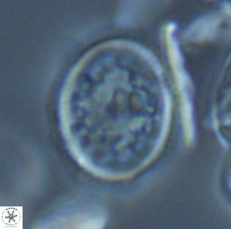 Dodekapodorhabdus noeliae 18849