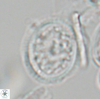 Dodekapodorhabdus noeliae 18854