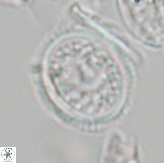 Dodekapodorhabdus noeliae 18855