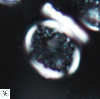 Dodekapodorhabdus noeliae 18856