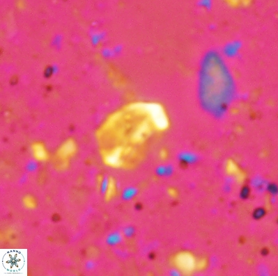 Duocameratus leariae 4455