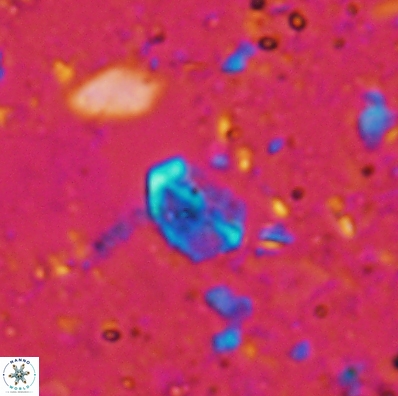 Duocameratus leariae 4451