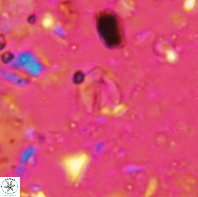 Duocameratus leariae 4466