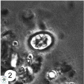 Eiffellithus equibiramus 8091
