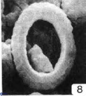 Watznaueria tubulata 9242