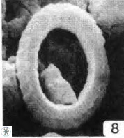 Watznaueria tubulata 9242