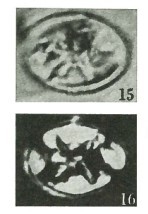 Eiffellithus turriseiffelii 16883