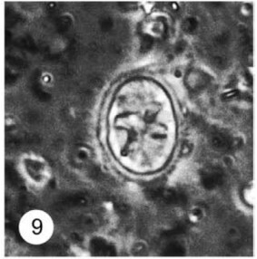 Eiffellithus vonsalisiae 28908