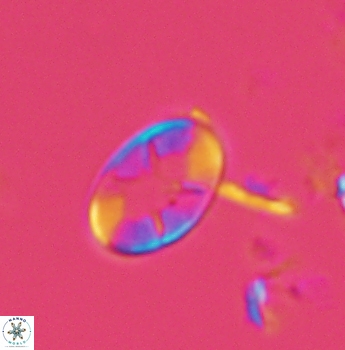 Eiffellithus casulus 4864