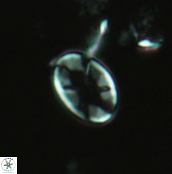 Eiffellithus casulus 4867