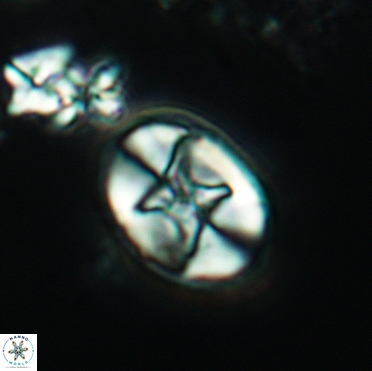 Eiffellithus casulus 03383