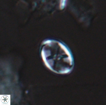 Eiffellithus casulus 10067