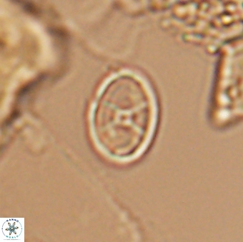 Eiffellithus casulus 10074