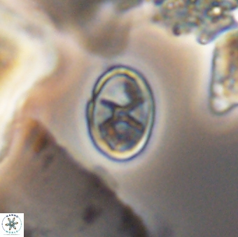 Eiffellithus casulus 10075