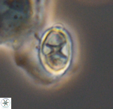 Eiffellithus casulus 10390