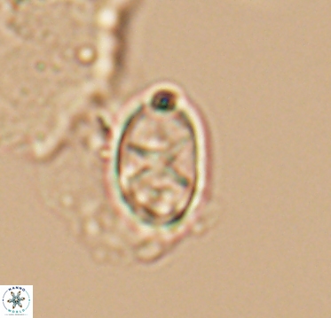 Eiffellithus casulus 10391