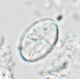 Eiffellithus bifidibrachia 18307