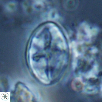Eiffellithus bifidibrachia 18309