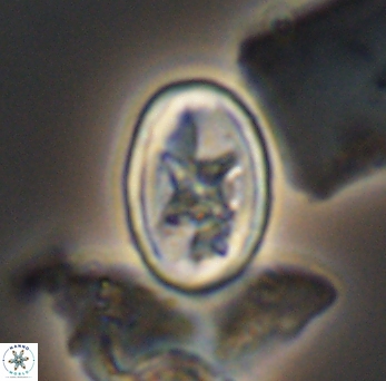 Eiffellithus gorkae 10134