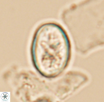 Eiffellithus gorkae 10135