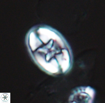 Eiffellithus gorkae 10136