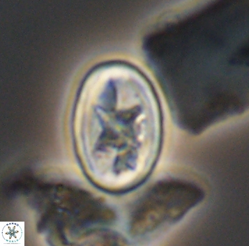 Eiffellithus gorkae 10287