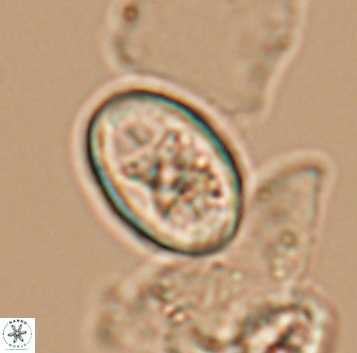 Eiffellithus gorkae 10288