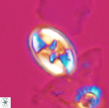 Eiffellithus gorkae 10290