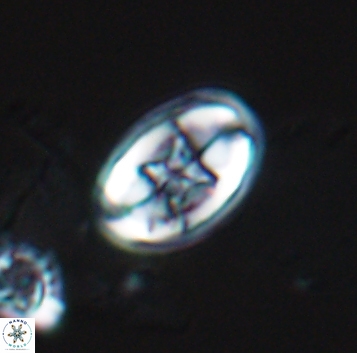 Eiffellithus gorkae 10293