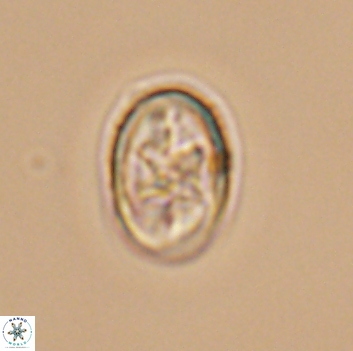 Eiffellithus gorkae 12073
