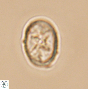 Eiffellithus gorkae 12138