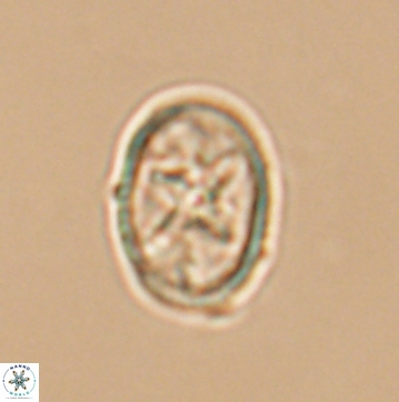 Eiffellithus gorkae 12139