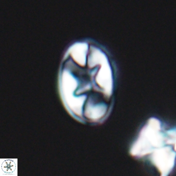 Eiffellithus gorkae 12158