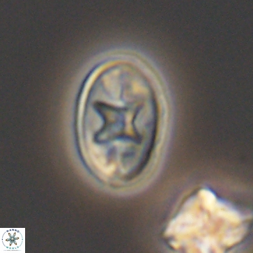 Eiffellithus gorkae 12164