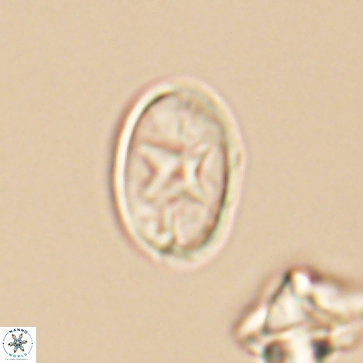 Eiffellithus gorkae 12162