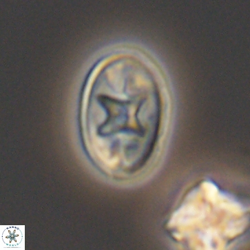 Eiffellithus gorkae 12163
