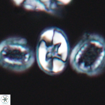 Eiffellithus gorkae 12186